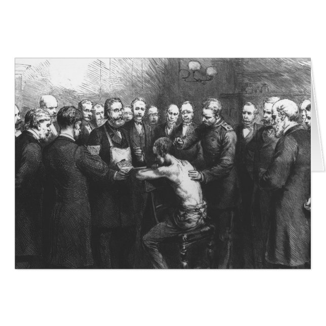 消費のためのKoch's Treatment先生の (正面横)