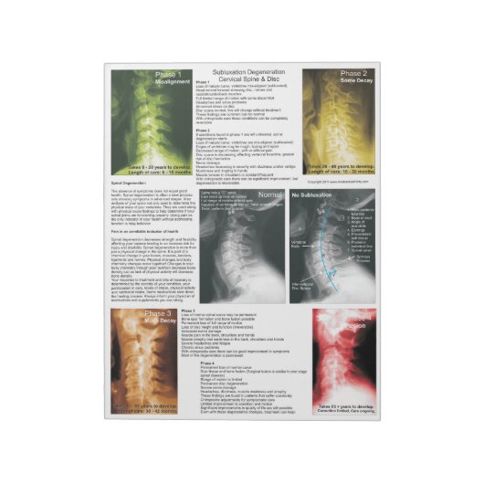 涙液浸出子宮頸部の変性 ノートパッド (回転)