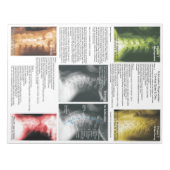 涙液浸出子宮頸部の変性 ノートパッド (正面)