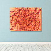 炭疽菌の顕微鏡的見解3 キャンバスプリント (インサイチュ (ウッドフロア))