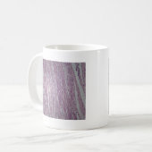 無害なtumoの人間の子宮のティッシュの細胞 コーヒーマグカップ (正面左)