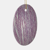 無害なtumoの人間の子宮のティッシュの細胞 セラミックオーナメント (右)