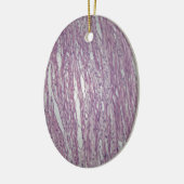 無害なtumoの人間の子宮のティッシュの細胞 セラミックオーナメント (左)