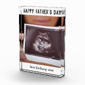 父の日妊娠スキャン フォトブロック (右)