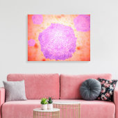 犬パルボウイルスの顕微鏡的見解2 キャンバスプリント (インサイチュ (リビング))