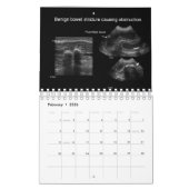 獣医用超音波カレンダー カレンダー (2月 2026)