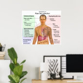 生魚類感染症の症状表 ポスター (ホームオフィス)