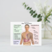 生魚類感染症の症状表 ポストカード (スタンド正面)