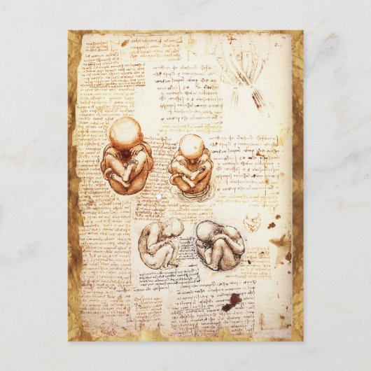 産婦人科胎内の胎児の見解 ポストカード (正面)