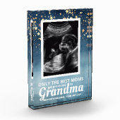 男の赤ちゃん超音波妊娠告知 フォトブロック (左)