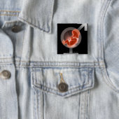 男性および女性の記号上の重ねられた胎児 缶バッジ (インサイチュ)