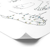 痛みと頭痛の鍼治療トリートメント ポスター (角)