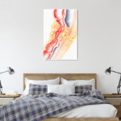 瘻孔の発達 キャンバスプリント (インサイチュ (寝室))