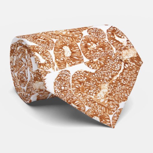 癌腫-腺癌- Cytokeratin IHC ネクタイ (ロール)