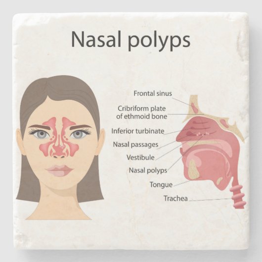 白い背景のシナス ストーンコースター (正面)
