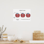 白内障手術ポスター ポスター (キッチン)