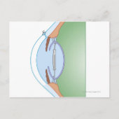 白内障手術 ポストカード (正面)