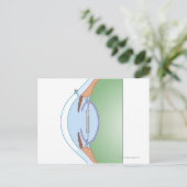 白内障手術 ポストカード (スタンド正面)