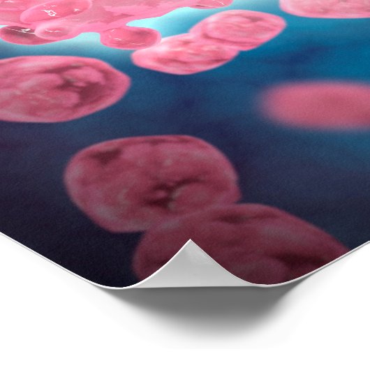 白血病細胞群の顕微鏡的見解 ポスター (角)