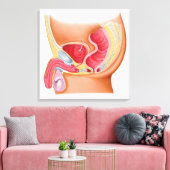 直腸尿道瘻孔の医学的イラストレーション キャンバスプリント (インサイチュ (リビング))
