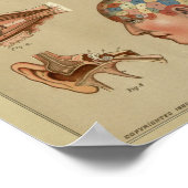 相学頭解剖学プリントヴィンテージ ポスター (角)