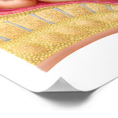 真空抽出を用いた胎児の分娩 ポスター (角)