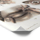 眼手術技術ヴィンテージ解剖学プリント ポスター (角)