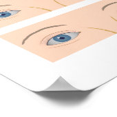 眼斜視障害ポスター ポスター (角)