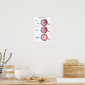 眼病緑内障ポスター ポスター (キッチン)