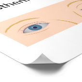 眼筋無力症ポスター ポスター (角)