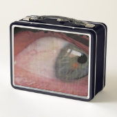 眼精疲労 メタルランチボックス (裏面)