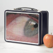 眼精疲労 メタルランチボックス (インサイチュ)