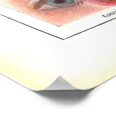 眼解剖学ポスターの病フランスの患 ポスター (角)