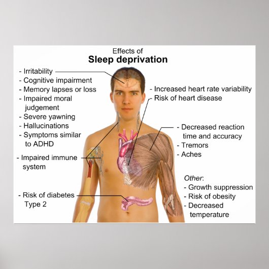 睡眠遮断が人の体に及ぼす影響 ポスター (正面)