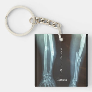 破断半径とUlna X線の「破断時間」 キーホルダー
