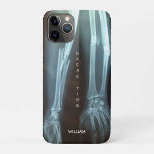 破断半径とUlna X線の「破断時間」    iPhone 11 Proケース