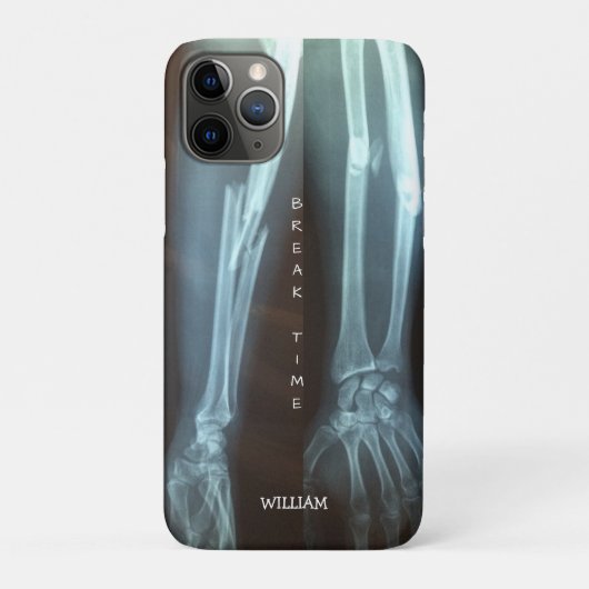 破断半径とUlna X線の「破断時間」 Case-Mate iPhoneケース (裏)