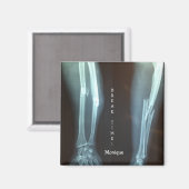 破断半径とUlna X線「破断時間」 マグネット (正面/裏面)