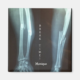 破断半径とUlna X線「破断時間」 マグネット