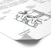 硬化体内臓痛の紹介チャート ポスター (角)