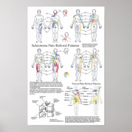 硬化体内臓痛の紹介チャート ポスター