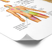 硬化体内臓痛の紹介ポスター ポスター (角)