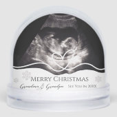 祖父母妊娠発表超音波 (正面)