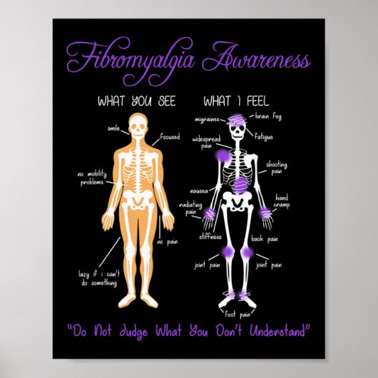 私のスケルトン感じ線維筋痛が見える ポスター (正面)