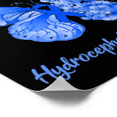 私の衣服ブルーは私の孫娘の水頭症 ポスター (角)