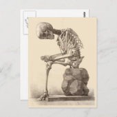 私の足は私を殺しています ポストカード (正面/裏面)