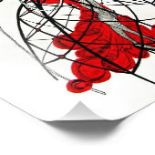 私の鉄肺 フォトプリント            (角)