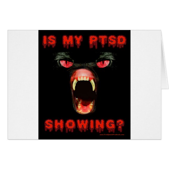 私のPTSDは示していますか。 (正面横)