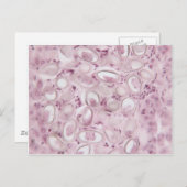 科学寄生虫 ポストカード (正面/裏面)