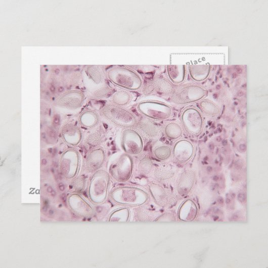 科学寄生虫 ポストカード (正面/裏面)